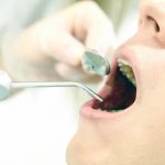 歯周病菌が生活習慣病の原因に！予防方法は？歯磨きのポイントは？